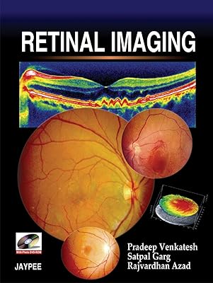 Retinal Imaging