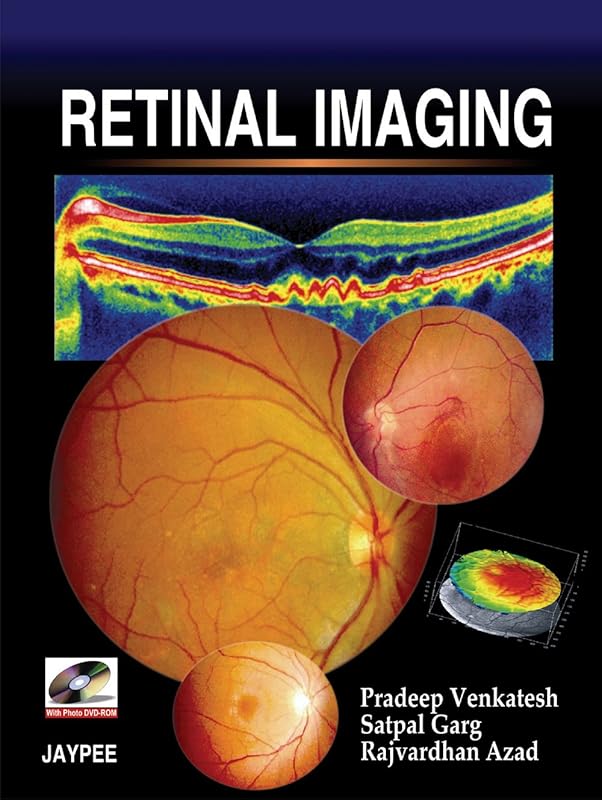 Retinal Imaging by Pradeep Venkatesh