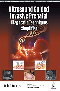 Ultrasound Guided 'Invasive Prenatal Diagnostic Techniques' Simplified by M.D. Sahetya, Raju R.