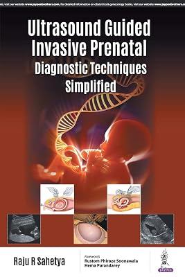 Ultrasound Guided 'Invasive Prenatal Diagnostic Techniques' Simplified