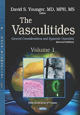 The Vasculitides: General Considerations and Systemic Vasculitis