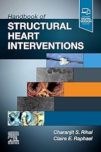 Handbook of Structural Heart Interventions by Charanjit S Rihal