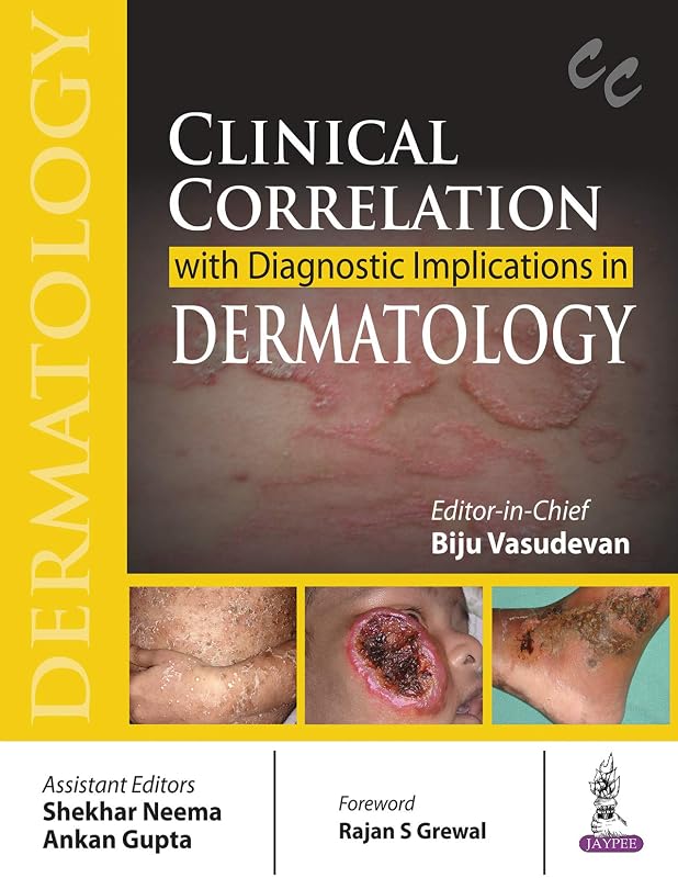 Clinical Correlation with Diagnostic Implications in Dermatology by Biju Vasudevan