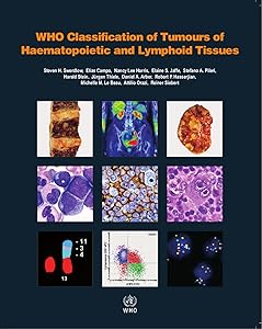 WHO Classification of Tumours of Haematopoietic and Lymphoid Tissues [OP] by WHO Classification of Tumours Editorial Board