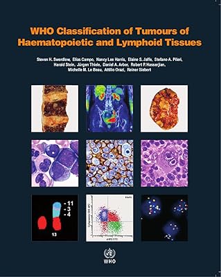 WHO Classification of Tumours of Haematopoietic and Lymphoid Tissues [OP]