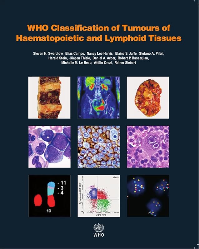 WHO Classification of Tumours of Haematopoietic and Lymphoid Tissues [OP] by WHO Classification of Tumours Editorial Board