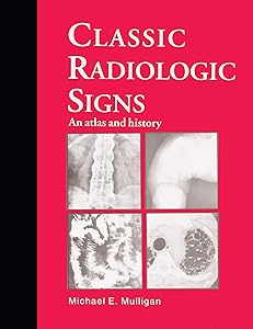 Classic Radiologic Signs: An Atlas and History by M.E. Mulligan