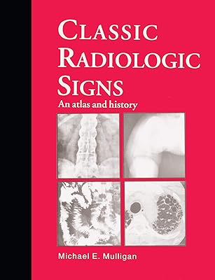 Classic Radiologic Signs: An Atlas and History