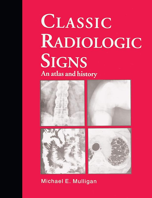 Classic Radiologic Signs: An Atlas and History by M.E. Mulligan