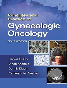 Principles and Practice of Gynecologic Oncology by Dennis Chi