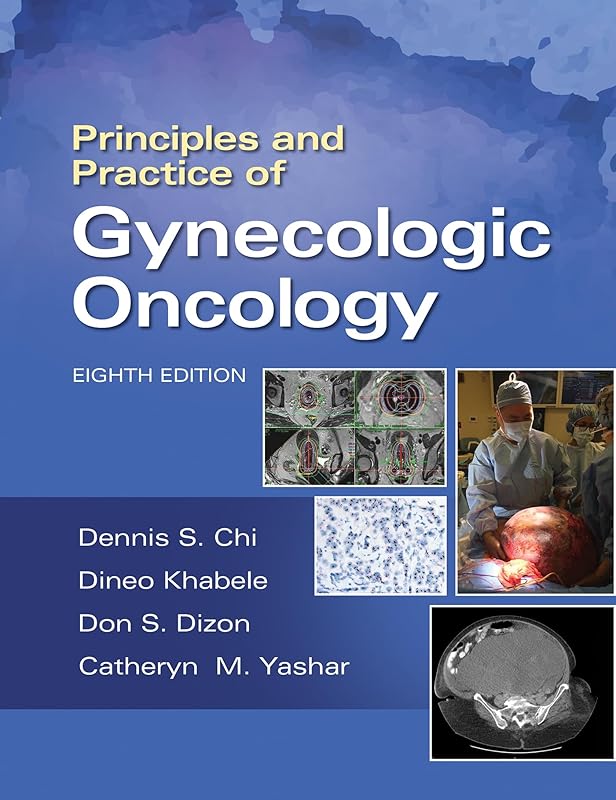 Principles and Practice of Gynecologic Oncology by Dennis Chi