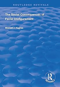 The Social Consequences of Facial Disfigurement (Routledge Revivals) by Michael J. Hughes