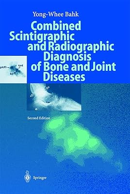 Combined Scintigraphic and Radiographic Diagnosis of Bone and Joint Diseases