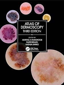 Atlas of Dermoscopy: Third Edition by Ashfaq A Marghoob