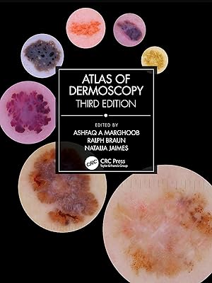 Atlas of Dermoscopy: Third Edition