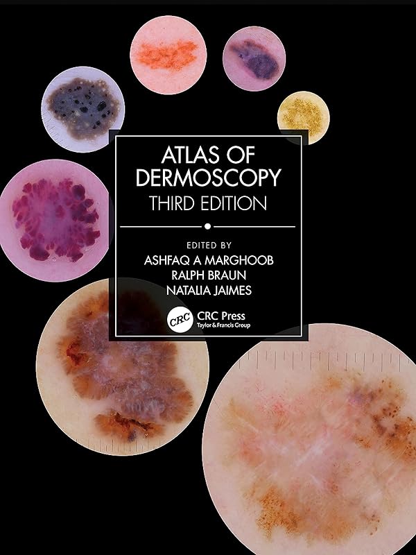 Atlas of Dermoscopy: Third Edition by Ashfaq A Marghoob