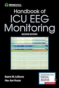 Handbook of ICU EEG Monitoring by Suzette LaRoche MD