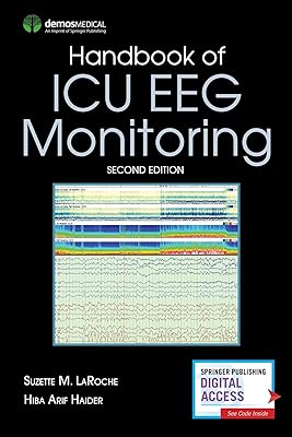 Handbook of ICU EEG Monitoring