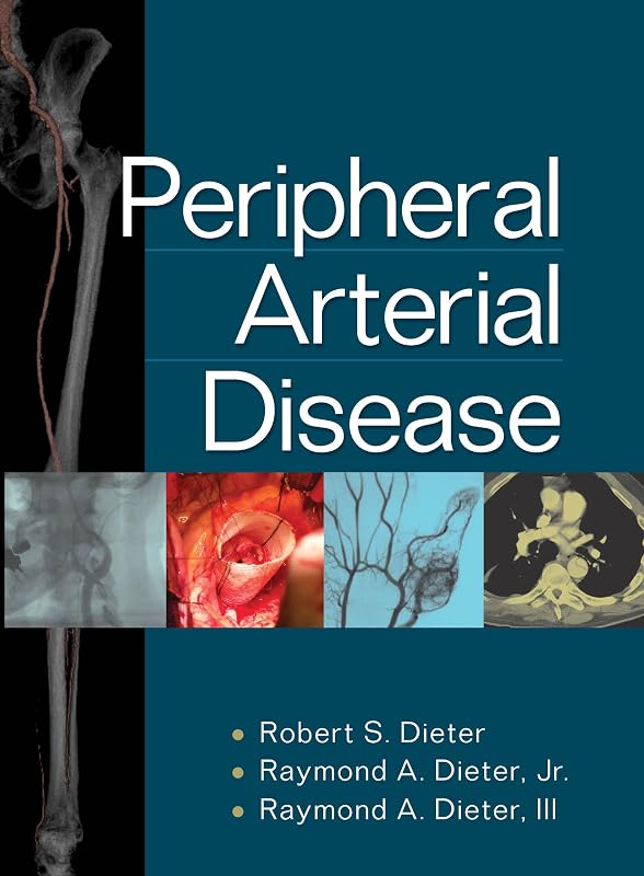 Peripheral Arterial Disease by Robert S. Dieter