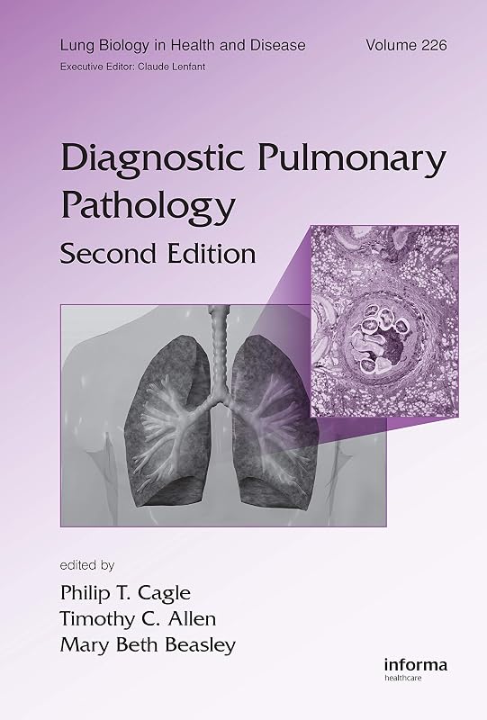 Diagnostic Pulmonary Pathology (Lung Biology in Health and Disease Book 226) by Philip T. Cagle
