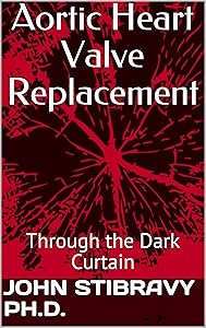 Aortic Heart Valve Replacement: Through the Dark Curtain by John Stibravy Ph.D.