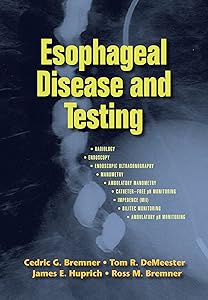 Esophageal Disease and Testing by Cedric G. Bremner