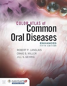 Color Atlas of Common Oral Diseases, Enhanced Edition by Robert P. Langlais