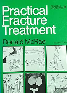 Practical Fracture Treatment by Ronald McRae