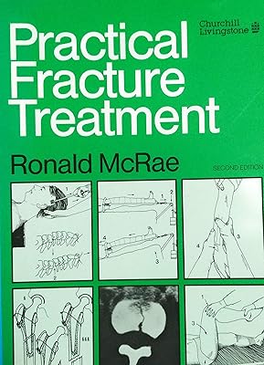 Practical Fracture Treatment