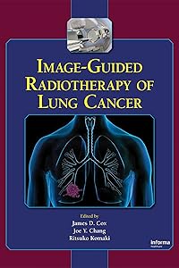 Image-Guided Radiotherapy of Lung Cancer by James D. Cox