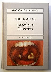 A colour atlas of infectious diseases (Wolfe medical atlases ; 8) by Ronald Temple Duncan Emond