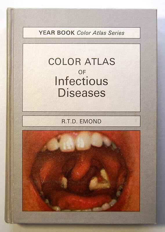 A colour atlas of infectious diseases (Wolfe medical atlases ; 8) by Ronald Temple Duncan Emond