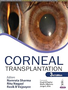 Corneal Transplantation by Namrata Sharma
