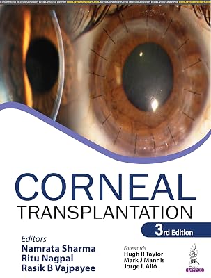 Corneal Transplantation