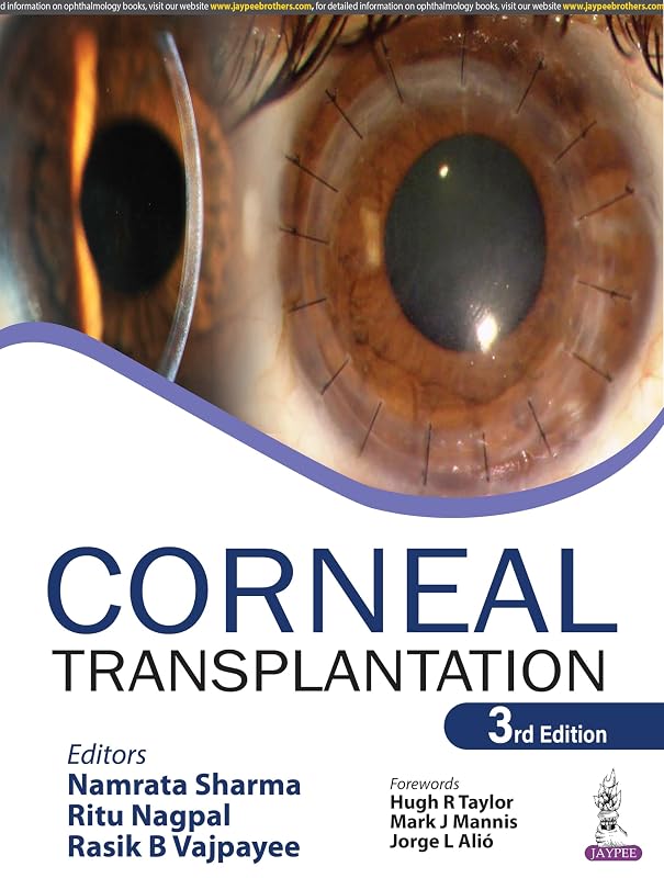 Corneal Transplantation by Namrata Sharma