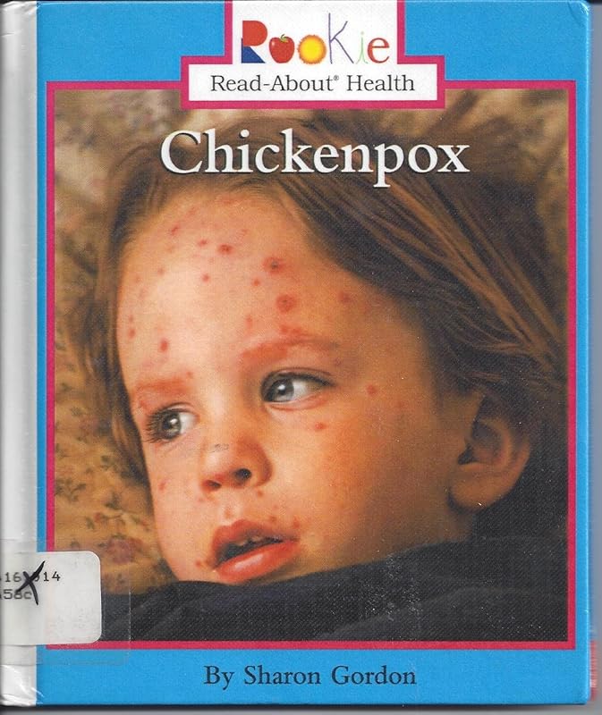 Chickenpox (Rookie Read-About Health) by Sharon Gordon