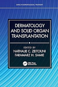 Dermatology and Solid Organ Transplantation (Series in Dermatological Treatment) by Nathalie C. Zeitouni