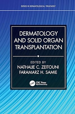 Dermatology and Solid Organ Transplantation (Series in Dermatological Treatment)