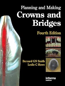 Planning and Making Crowns and Bridges by Bernard G. N. Smith