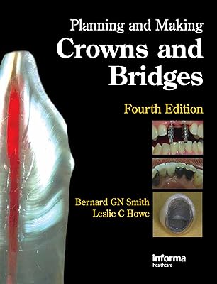 Planning and Making Crowns and Bridges