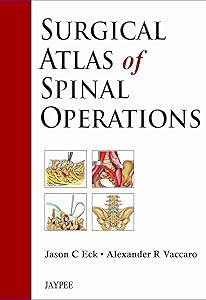 Surgical Atlas of Spinal Operations by Jason C. Eck