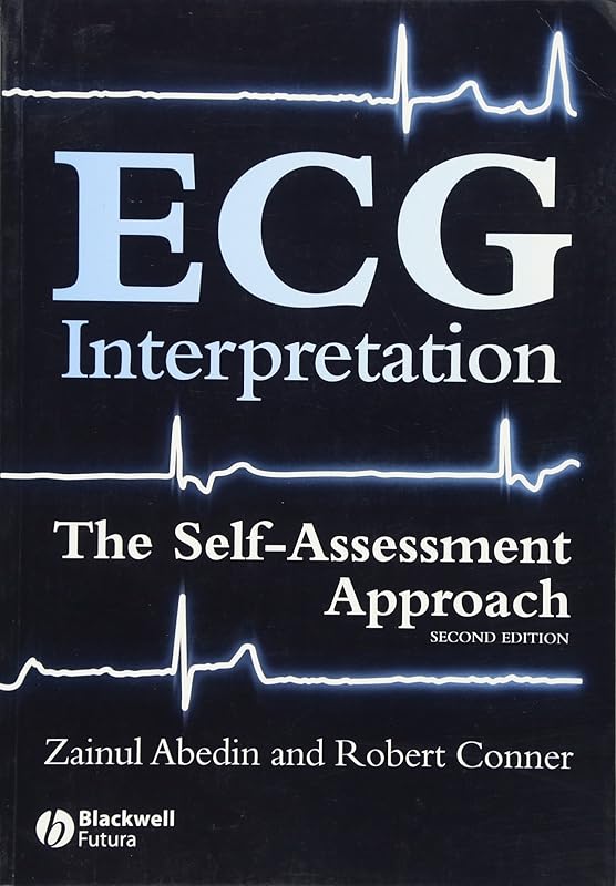 ECG Interpretation: The Self-Assessment Approach by Zainul Abedin