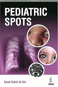 Pediatric Spots by Said Saleh Al Ani