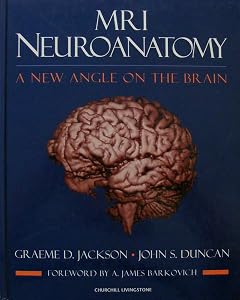 MRI Neuroanatomy by Graeme D. Jackson
