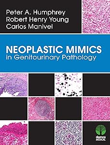 Neoplastic Mimics in Genitourinary Pathology (Pathology of Neoplastic Mimics) by Peter Humphrey MD