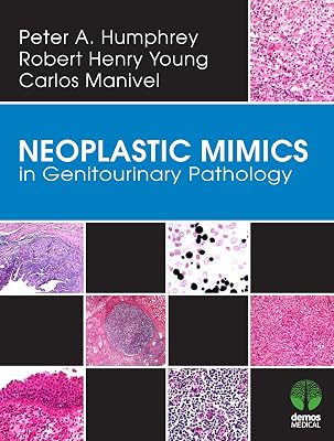 Neoplastic Mimics in Genitourinary Pathology (Pathology of Neoplastic Mimics)