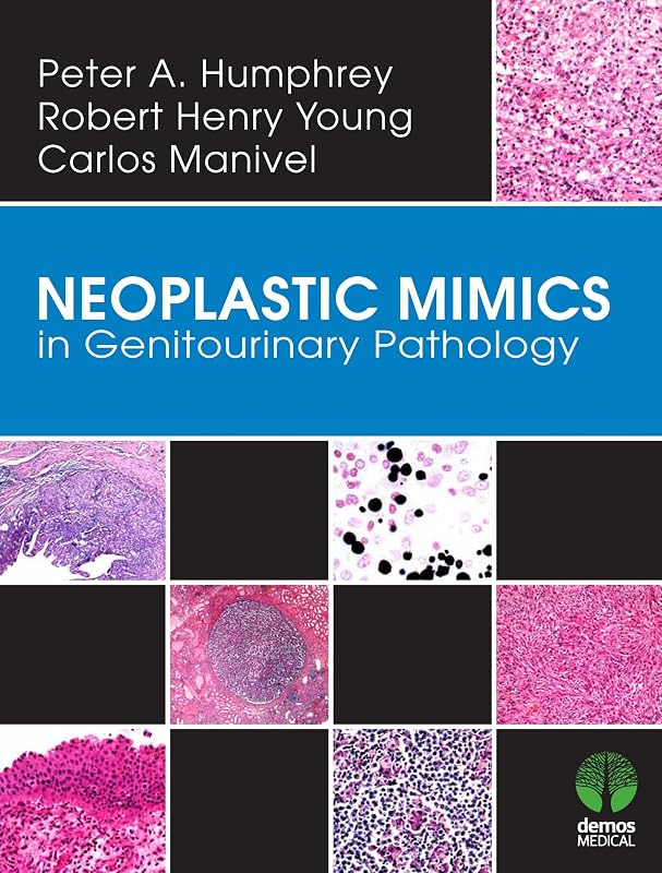 Neoplastic Mimics in Genitourinary Pathology (Pathology of Neoplastic Mimics) by Peter Humphrey MD