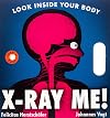 X-Ray Me!: Look Inside Your Body