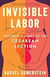 Invisible Labor: The Untold Story of the Cesarean Section