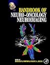 Handbook of Neuro-Oncology Neuroimaging